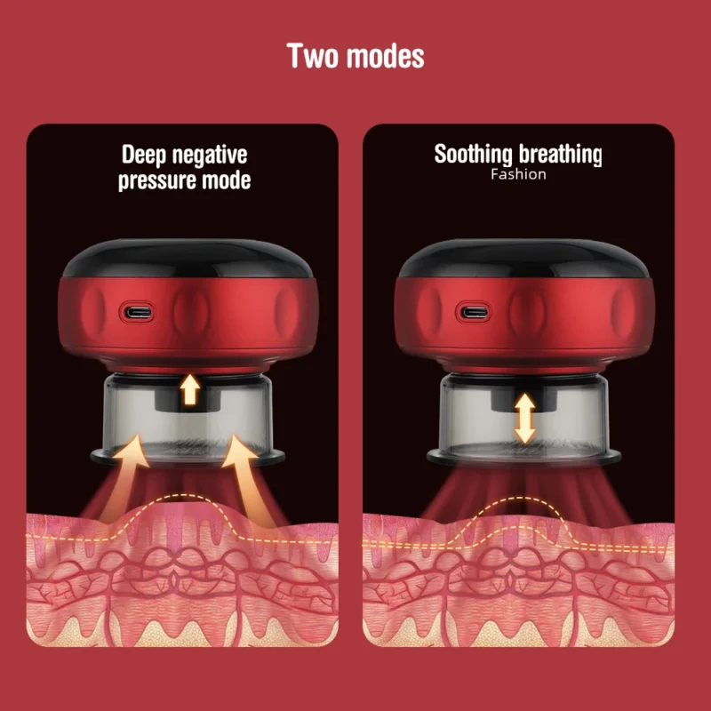 electric cupping massage